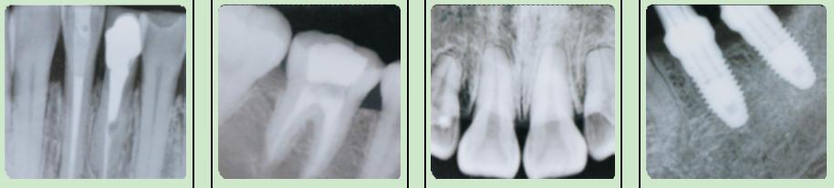 WMV-671A2 Veterinary dental X-ray unit is high frequency machine