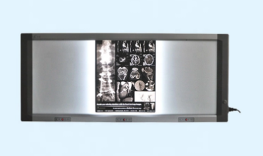 56"*17" xray viewer Medical film viewer/x ray film viewer/x-ray film viewing box