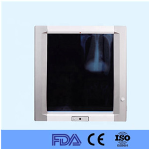 Hospital LED X Ray medical film viewer