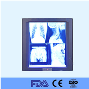Hospital LED X Ray medical film viewer