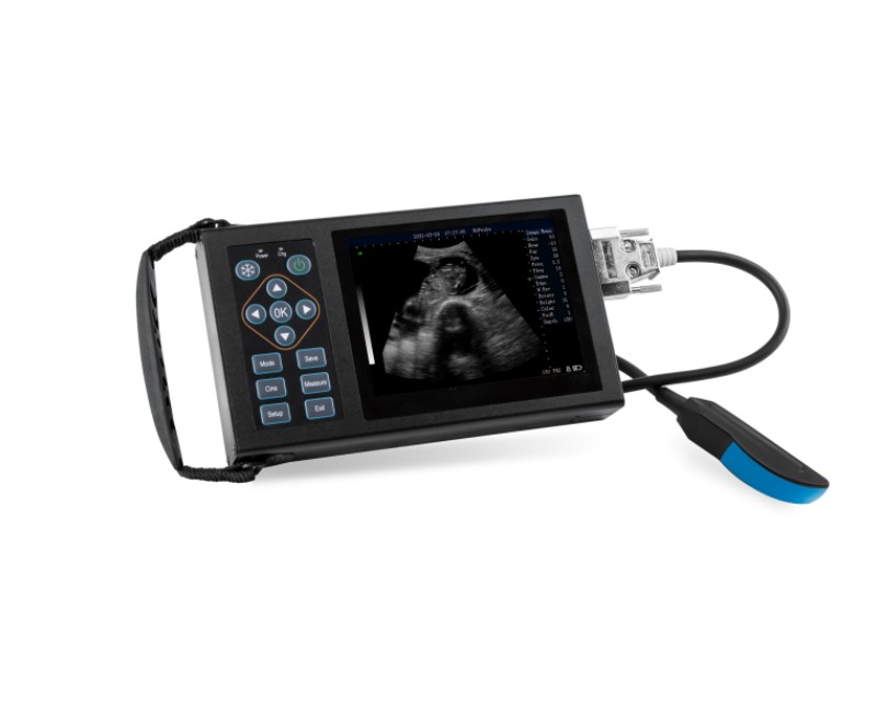 Full Digital Ultrasonic Diagnostic Instrument  WMV-A20